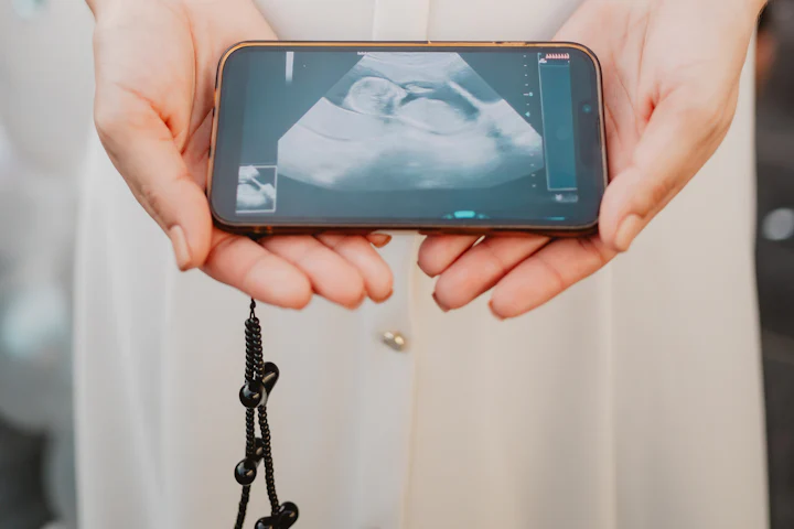 Hands holding a phone that shows a pregnancy ultrasound image