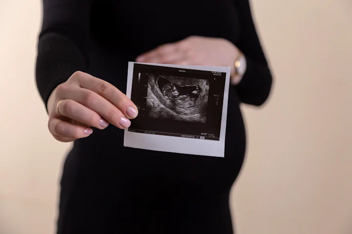Pregnant person holding a printed ultrasound image in front of their bump